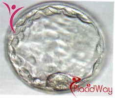 Slider image (4) Main Line Fertility Center